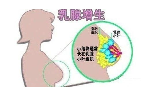 乳房出现“青筋”是什么原因呢？