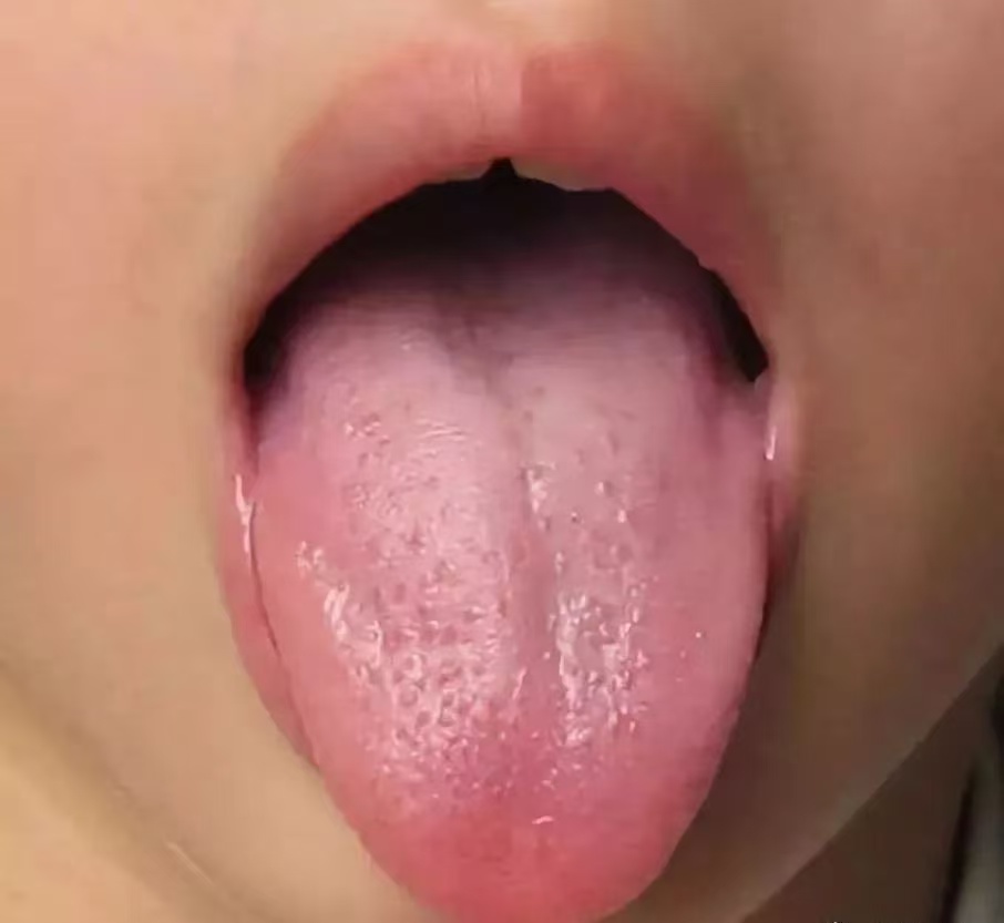 过度喂养危害大，宝宝发出的积食信号你能看懂多少？