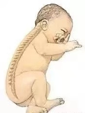 【母婴知识】“头”等大事，新生儿枕头使用须知！